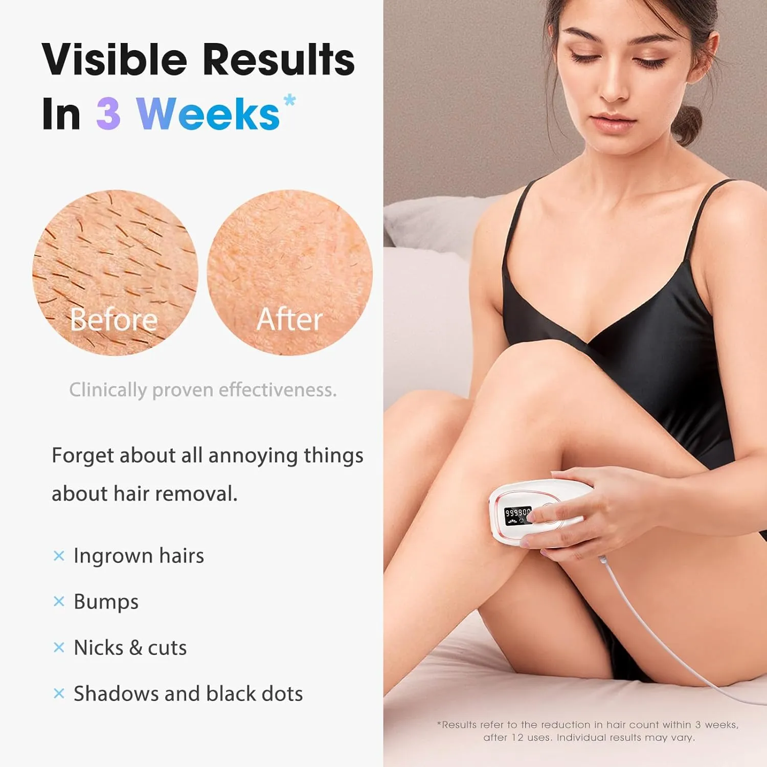 IPL Laser Hair Removal Device for Women & Men - Home 45°F Ice-Cooling Contact for Painless & Long-Lasting Results, 86% Hair Reduction in 3 Weeks for Full Body & Bikini Line, White